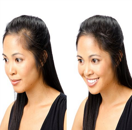 Best Permanent Hair Weaving Services in Kolkata at AK Hair Wig..