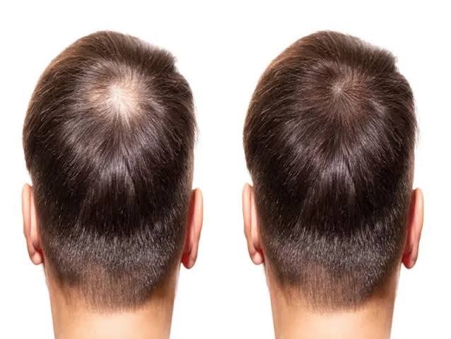 Hair Weaving Services in Kolkata at AK Hair Wig