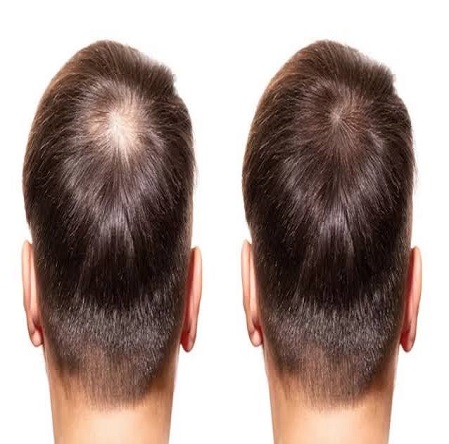 Hair Weaving Services in Kolkata at AK Hair Wig - Copy