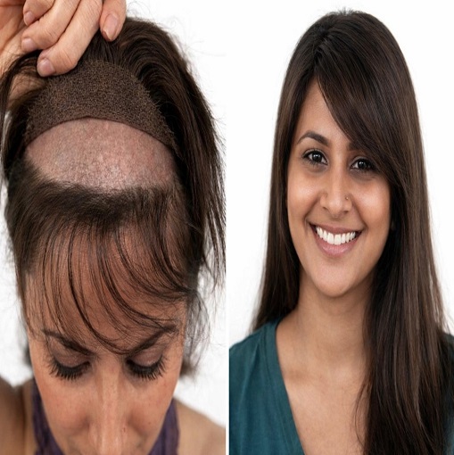 Hair Wig in Kolkata for Women