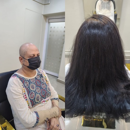 Hair Wig in Kolkata