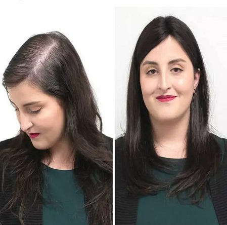 Hair-weaving-for-Womens-Kolkata