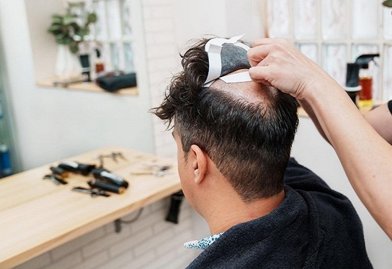 Hair Fixing Service in Kolkata for Men-Women-AK Hair Wig-Kolkata-Alipore