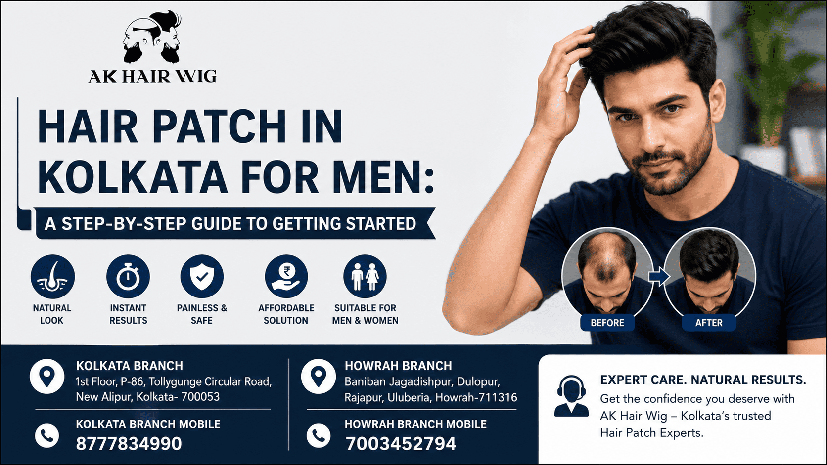 Hair Patch in Kolkata for Men A Step-by-Step Guide to Getting Started- AK Hair Wig-Hair Patch in Kolkata-For Men